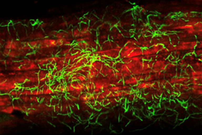 En­do­phytic Strep­to­myces & Plant Growth