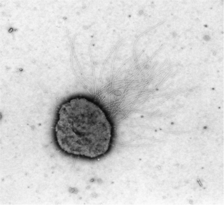 All the World Is Not E. coli