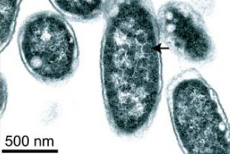 Salmonella's Ex­clu­sive In­testi­nal Restau­rant