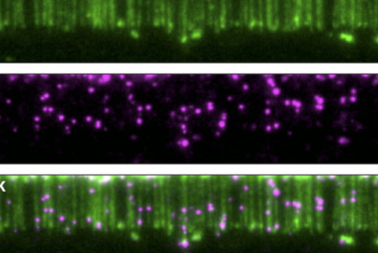 Cell Di­vi­sion Through DNA Cur­tains