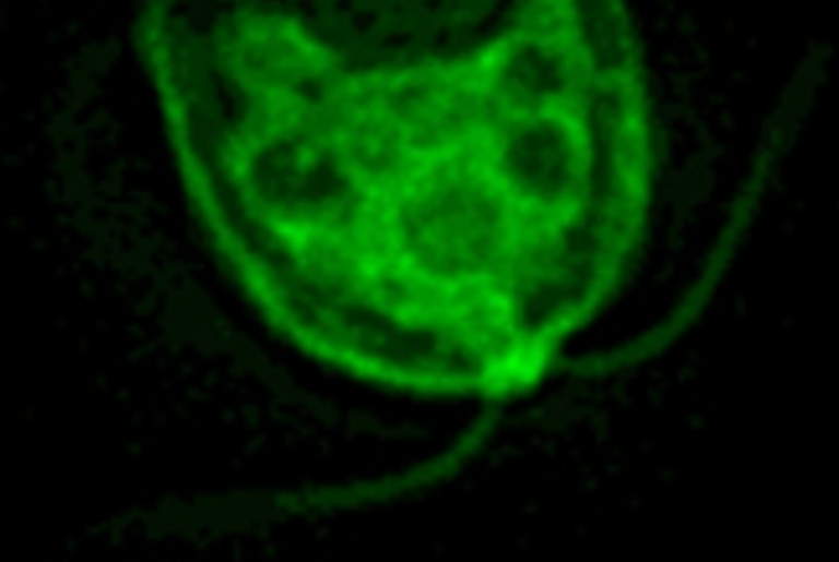 Fish­ing With Al­gae For Malaria Vac­cines
