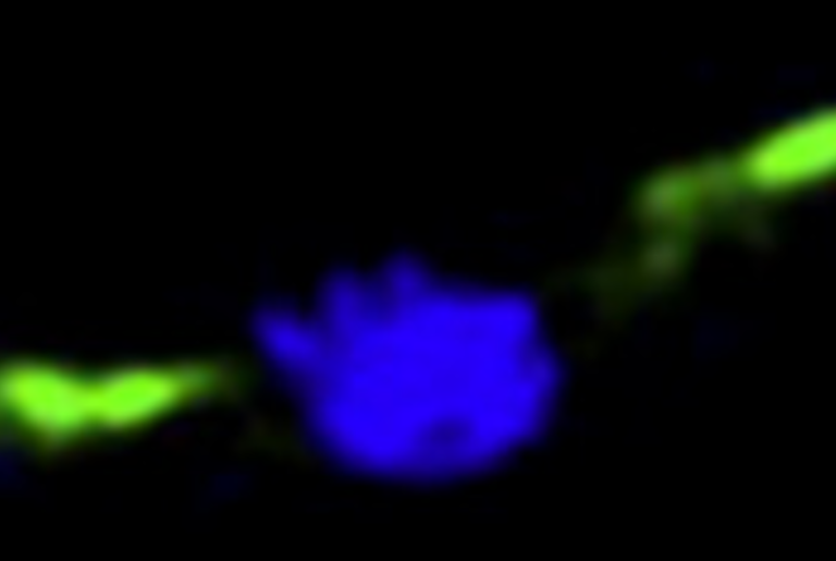 Phee ɸ Phoh PhuZ: A Tale of Gi­ant Phage with a Furtive Tubu­lin
