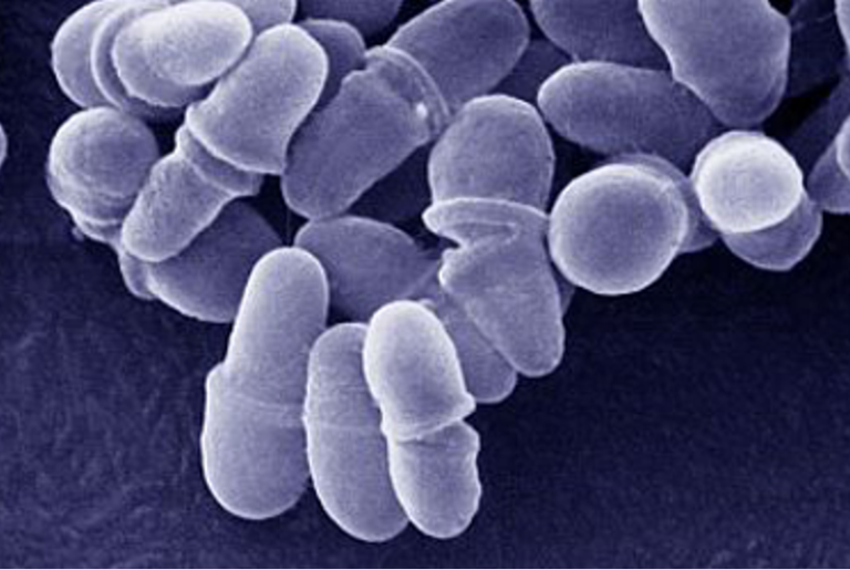 Dan­druff-Caus­ing Skin Fungi Dis­cov­ered...