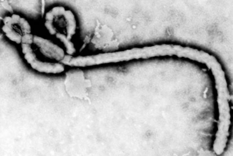 Five Ques­tions about Filoviruses