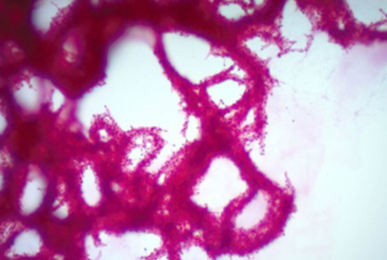 Weak­en­ing The My­colic Acid Fortress of M. tu­ber­cu­lo­sis