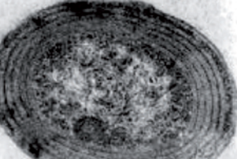 Prochloro­cocci to the Head of the Class